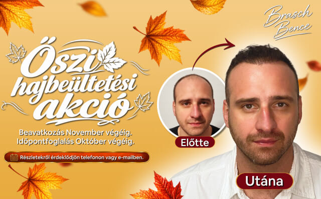 Őszi hajbeültetési akció - HIMG hajbeültetési klinika